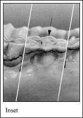 JPG-Worn third premolar